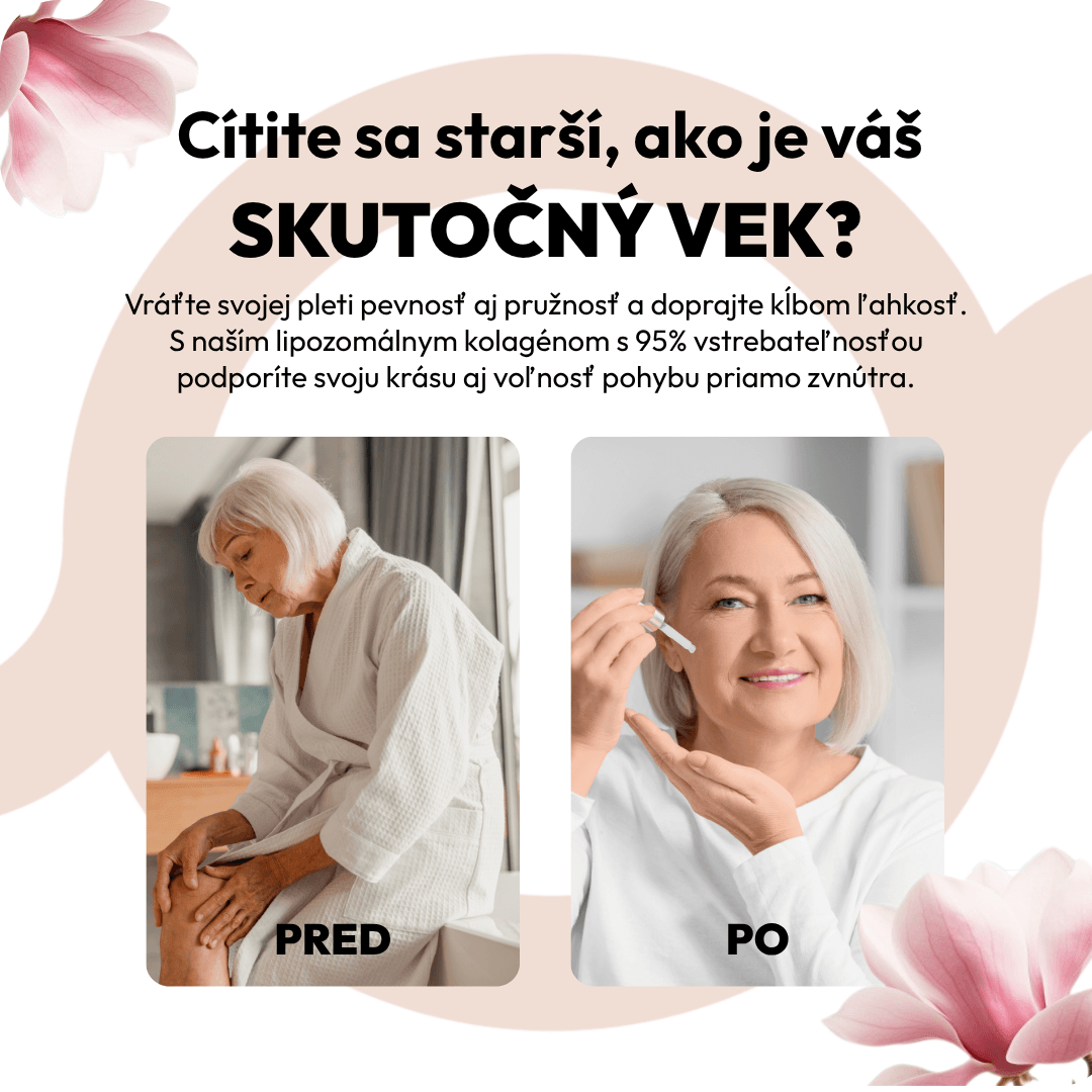 Kolagen 2 SK